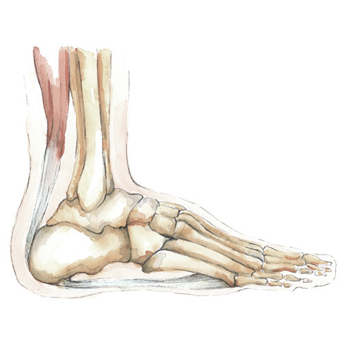 Plantar Fasciitis - Orthopaedics SA